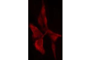 Immunofluorescence (fixed cells) (IF/ICC) image for anti-Proteasome (Prosome, Macropain) 26S Subunit, Non-ATPase, 11 (PSMD11) (Internal Region) antibody (ABIN6257765)