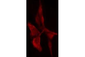 ABIN6274714 staining 293 cells by IF/ICC. (PSMD11 抗体  (Internal Region))