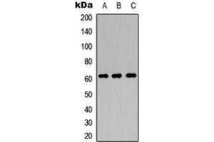 Western blot analysis of OCTN1 expression in MCF7 (A), NS-1 (B), PC12 (C) whole cell lysates. (SLC22A4 抗体  (Center))