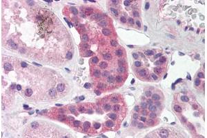 Human Kidney (formalin-fixed, paraffin-embedded) stained with RPAIN antibody ABIN214468 at 5 ug/ml followed by biotinylated goat anti-rabbit IgG secondary antibody ABIN481713, alkaline phosphatase-streptavidin and chromogen. (RPAIN 抗体  (C-Term))