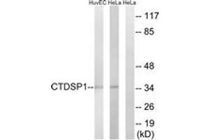 Western Blotting (WB) image for anti-CTD (Carboxy-terminal Domain, RNA Polymerase II, Polypeptide A) Small Phosphatase 1 (CTDSP1) (AA 1-50) antibody (ABIN1534738)