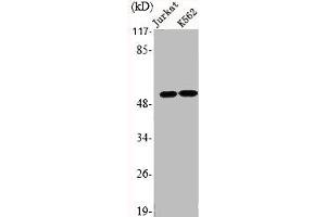 Western Blot analysis of Jurkat K562 cells using EMR4 Polyclonal Antibody (EMR4P 抗体  (Internal Region))