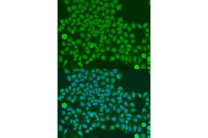 Immunofluorescence analysis of U2OS cells using TARDBP antibody. (TARDBP 抗体  (AA 1-100))