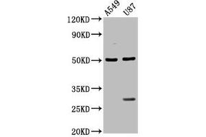 Western Blot Positive WB detected in: A549 whole cell lysate, U87 whole cell lysate All lanes: LANCL2 antibody at 3. (LANCL2 抗体  (AA 2-106))