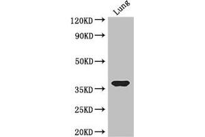 Western Blot Positive WB detected in: Mouse lung tissue All lanes: HOXD9 antibody at 3. (HOXD9 抗体  (AA 38-276))