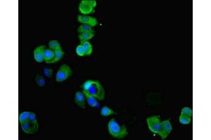 Immunofluorescent analysis of MCF-7 cells using ABIN7148667 at dilution of 1:100 and Alexa Fluor 488-congugated AffiniPure Goat Anti-Rabbit IgG(H+L) (CKMT1A 抗体  (AA 40-417))