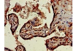 Immunohistochemistry of paraffin-embedded human placenta tissue using ABIN7169773 at dilution of 1:100 (SKIL 抗体  (AA 359-579))