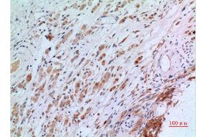 Immunohistochemistry (IHC) analysis of paraffin-embedded Human Brain, antibody was diluted at 1:100. (CGREF1 抗体  (N-Term))