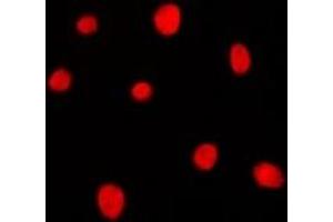 Immunofluorescent analysis of MRG15 staining in K562 cells. (MORF4L1 抗体)
