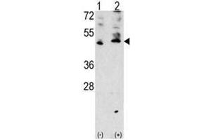 Image no. 1 for anti-Vascular Endothelial Growth Factor C (VEGFC) (AA 255-285), (Middle Region) antibody (ABIN357425)