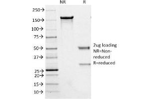 SDS-PAGE (SDS) image for anti-Neurofilament, Heavy Polypeptide (NEFH) antibody (ABIN6940184)
