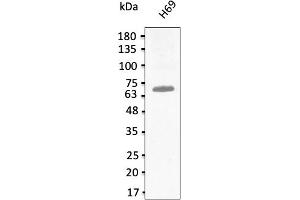 Western Blotting (WB) image for anti-T-Box 18 (TBX18) (C-Term) antibody (ABIN7272987) (T-Box 18 抗体  (C-Term))
