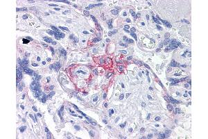 Anti-BUB1B / BubR1 antibody IHC of human placenta. (BUB1B 抗体  (AA 1-130))