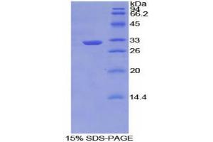 SDS-PAGE analysis of Mouse TNIP2 Protein. (TNIP2 蛋白)