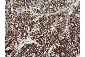 Image no. 15 for anti-Src-like-adaptor 2 (SLA2) antibody (ABIN1500949)