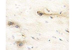 IHC analysis of FFPE human brain tissue stained with MARK1 antibody (MARK1 抗体  (AA 6-40))