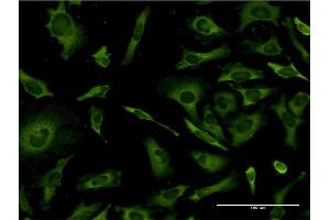 Immunofluorescence (IF) image for anti-Ribosomal Protein L36a (RPL36A) (AA 7-106) antibody (ABIN519871)