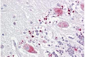Anti-C12orf5 / TIGAR antibody IHC staining of human brain, cerebellum. (TIGAR 抗体  (AA 140-190))