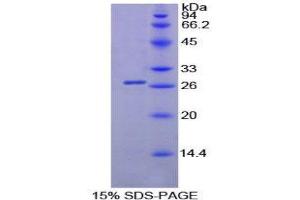 SDS-PAGE (SDS) image for Pancreatic Lipase (PNLIP) (AA 201-412) protein (His tag) (ABIN2125697)