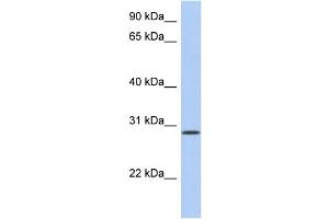 WB Suggested Anti-HAVCR2 Antibody Titration:  0. (TIM3 抗体  (N-Term))