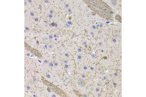 Immunohistochemistry of paraffin-embedded Mouse brain using CNP antibody at dilution of 1:100 (x400 lens). (Cnpase 抗体)
