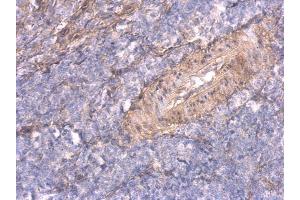 IHC-P Image TNFalpha-IP 2 antibody [C1C3] detects TNFalpha-IP 2 protein at cytosol on mouse spleen by immunohistochemical analysis. (TNIP2 抗体  (Center))