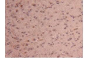 Detection of CPB2 in Mouse Brain Tissue using Polyclonal Antibody to Carboxypeptidase B2 (CPB2) (CPB2 抗体  (AA 187-327))