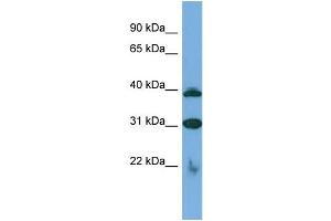 Host:  Rabbit  Target Name:  SLC1A6  Sample Type:  Jurkat Whole cell lysates  Antibody Dilution:  1. (SLC1A6 抗体  (C-Term))
