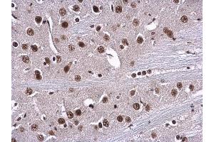 IHC-P Image RPA70 antibody [C1C3] detects RPA1 protein at nucleus in mouse brain by immunohistochemical analysis. (RPA1 抗体  (C-Term))