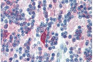 Human Brain, Cerebellum (formalin-fixed, paraffin-embedded) stained with MAP2 antibody ABIN462127 followed by biotinylated anti-mouse IgG secondary antibody ABIN481714, alkaline phosphatase-streptavidin and chromogen. (MAP2 抗体)