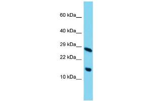 Host: Rabbit Target Name: C11orf52 Sample Type: HepG2 Whole Cell lysates Antibody Dilution: 1. (C11ORF52 抗体  (C-Term))