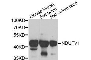 Western blot analysis of extracts of various cells, using NDUFV1 antibody. (NDUFV1 抗体)