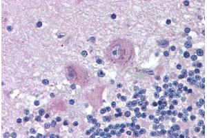 Human Brain, Cerebellum (formalin-fixed, paraffin-embedded) stained with SNX26 antibody ABIN290200 at 2. (SNX26 抗体  (AA 1113-1126))