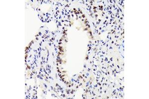Immunohistochemistry of paraffin-embedded rat lung using EWSR1 Rabbit mAb (ABIN7267053) at dilution of 1:100 (40x lens).