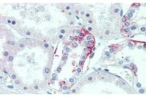 Detection of TMEM27 in Human Kidney Tissue using Polyclonal Antibody to Transmembrane Protein 27 (TMEM27) (TMEM27 抗体  (AA 15-141))