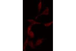 ABIN6275037 staining  HepG2 cells by IF/ICC. (NCAPG 抗体  (C-Term))