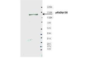 Western blot using  affinity purified anti-Spa310 antibody shows detection of endogenous pRb2/p130 protein in whole LNCaP cell extracts. (p130 抗体)