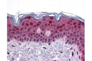 Anti-FAM120B antibody IHC of human skin. (FAM120B 抗体  (C-Term))
