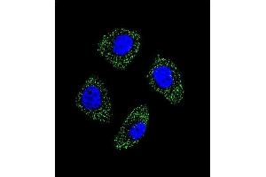 Confocal immunofluorescent analysis of EDN1 Antibody (Center)  with A549 cell followed by Alexa Fluor 488-conjugated goat anti-rabbit lgG (green). (Endothelin 1 抗体  (Center))