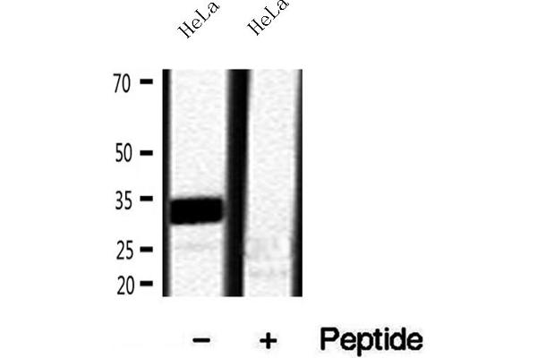 Ribonuclease H1 抗体  (Internal Region)