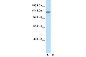 WB Suggested Anti-TIMELESS Antibody Titration:  2. (TIMELESS 抗体  (C-Term))