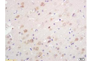 Formalin-fixed and paraffin embedded rat brain tissue labeled with Anti S-100/S100A1 Polyclonal Antibody, Unconjugated (ABIN728983) at 1:200 followed by conjugation to the secondary antibody and DAB staining. (S100A1 抗体)