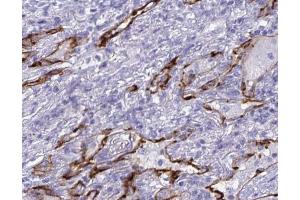 ABIN6268712 at 1/100 staining human lung tissues sections by IHC-P. (Aquaporin 4 抗体  (Internal Region))