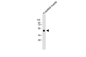 Anti-WIF1 Antibody (Human C-term) at 1:2000 dilution + Human skeletal muscle lysate Lysates/proteins at 20 μg per lane. (WIF1 抗体  (C-Term))