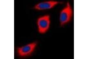 Immunofluorescent analysis of EPHA1 staining in Hela cells.