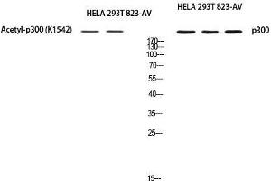 Western Blot (WB) analysis of HeLa 293T 823-AV using EP300 antibody. (p300 抗体)