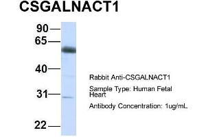Host:  Rabbit  Target Name:  CSGALNACT1  Sample Type:  Human Fetal Heart  Antibody Dilution:  1. (CSGALNACT1 抗体  (C-Term))