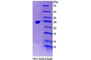 SDS-PAGE (SDS) image for Discs, Large Homolog 5 (DLG5) (AA 1724-1917) protein (His tag) (ABIN6239242) (DLG5 Protein (AA 1724-1917) (His tag))
