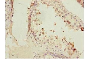 Immunohistochemistry of paraffin-embedded human testis tissue using ABIN7153074 at dilution of 1:100 (FOXN2 抗体  (AA 172-431))