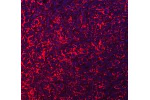 IF analysis of ACAD9 using anti-ACAD9 antibody (ABIN7602670).